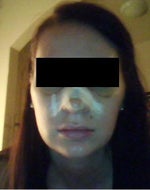 Day 5 - post op