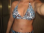 10 DAYS POST OPT NEW ME