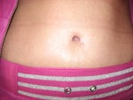 4 WEEKS UPCLOSE OF NEW BELLY BUTTON