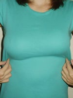 Breast augmentation, post op