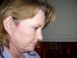 Right side with head tipped. Looser skin along the jawline