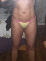 3 mo post op inner, outer thigh, flank, ab 3/09