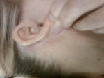 Behind Right Ear