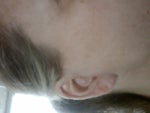 Right ear front
