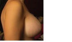 right side view larger breast