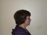 right profile - before