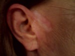 This is what I'm left with after He fixed it and now won't respond to my messages. My ear's cold and painful 24/7 and he did this is January 09 for the last time.