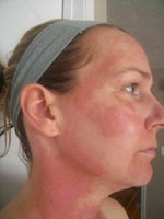 Side view - uneven application?