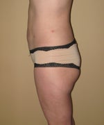 Side 3 weeks