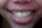 before - Yuck I picked my yellowest teeth pic!