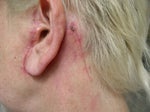 ta neck scars.JPG