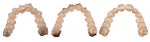 Rosie's top teeth (from left to right) - beginning of Treatment Sept '08 - Middle of treatment Feb '09 - and July '09.