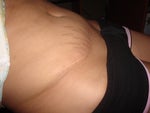 laying down the bulge does not sink in