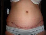 9 weeks