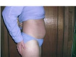 tummy1.jpg