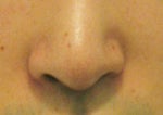 Asymmetrical Nostrils
