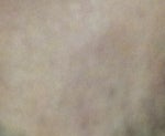 Dettol on my face skin Dettol on my face skin
