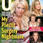 Tara Reid's plastic surgery nightmare