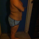 Before, Day of Lipo... 150 pounds