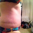 Right side