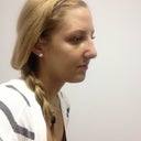 Serious swelling.. Immediately after cast removal!