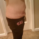 6 months post op