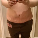 6 months post op