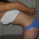 6 weeks post op - bent over side view