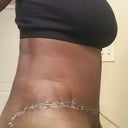PO Day 15 - Rt side
