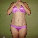 6 weeks pre-op