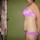 6 weeks pre-op