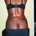 no bruising so far, excuse my ashy butt!