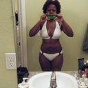 11 days post op