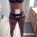 POD 21 finally made it to 3 weeks trying on new undies and bras swelling kicking in big time below belly button above incision.