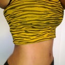 side view 4 months post op:)