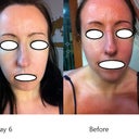 Day 6 vs Before
