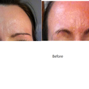 Day 6 vs before