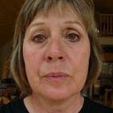 Before surgery age 59