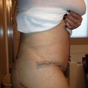 Me in the morning!  I can't wait until all of the tape is off!