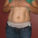 The day before surgery