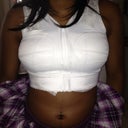 Post-op day 3. Tummy is still pretty bloated, but there are no drains :)