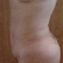 3 1/2 weeks post op,this side of my body/is softer and has less swelling