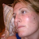 this is the next night after ill, you can really see my dark spots