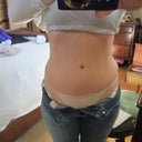 Low scar!  3/29/13 - 2 years post TT & 1 month post dog ear removal - marks are from jeans