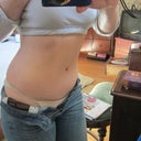 At an angle - 3/29/13 - 2 years post TT & 1 month post dog ear removal!  Love it!!