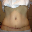 2 days from 11 weeks po. Christmas Day!