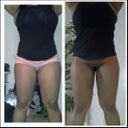 44 days post op