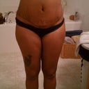 2 weeks. Very swollen. Ugh.