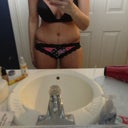Pretty Hunched this morning but getting a little less swollen 
15 days post op