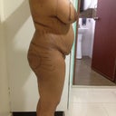 Before surgery